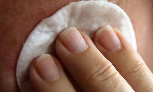 Farvel til bumser: 8 effektive metoder mod akne